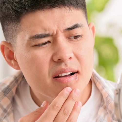 how to get rid of a cold sore in 24 hours