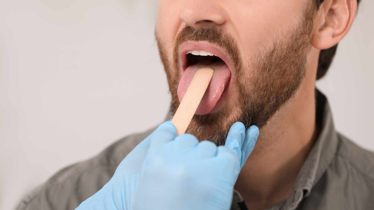 why is my tongue swollen and sore on the sides