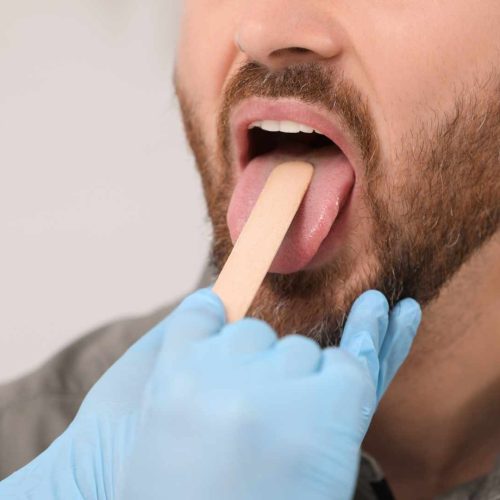 why is my tongue swollen and sore on the sides