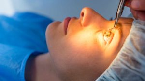 LASIK Surgery and Growth on the Eye